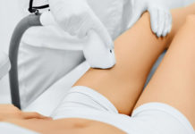 Depilazione laser: i costi e i vantaggi