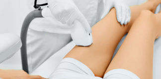 Depilazione laser: i costi e i vantaggi