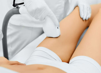 Depilazione laser: i costi e i vantaggi