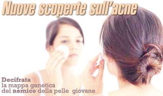 acne decifrata la mappa genetica del batterio che ne e responsabile_O1