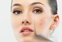 Ansia e macchie rosse sulla pelle ansia e macchie rosse sulla pelle_O1