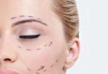 Chirurgia chirurgia_O1