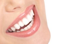 Come sbiancare i denti come sbiancare i denti_O1
