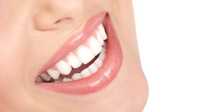 come sbiancare i denti_O1