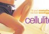 I rimedi anticellulite i rimedi anticellulite_O1
