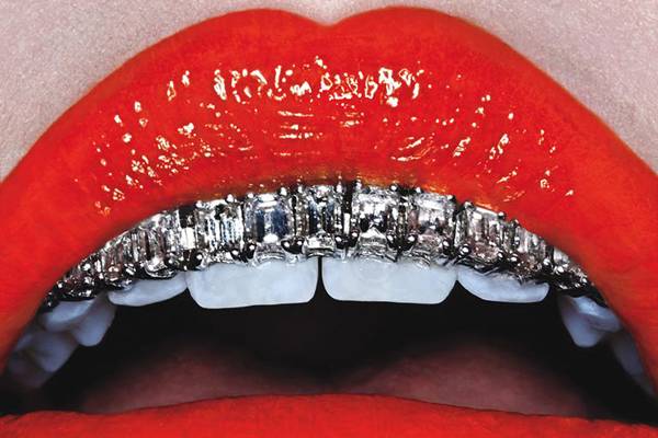 la moda dei grillz_O1