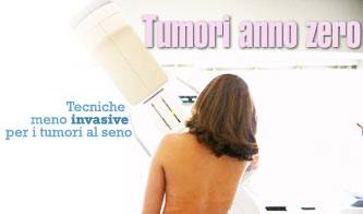 medicina tumori al seno ai nastri di partenza_O1
