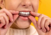 I segreti per un sorriso splendente: l’ortodonzia invisibile