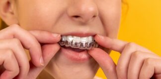 I segreti per un sorriso splendente: l’ortodonzia invisibile