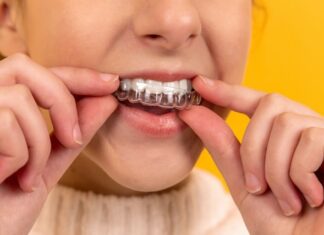 I segreti per un sorriso splendente: l’ortodonzia invisibile