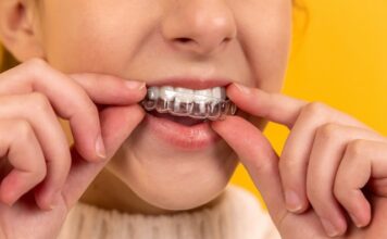 I segreti per un sorriso splendente: l’ortodonzia invisibile
